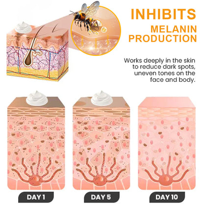 ⏳ Summer Deal 49% OFF ✨ Kolirin™ Bee Venom Dark Spot Corrector