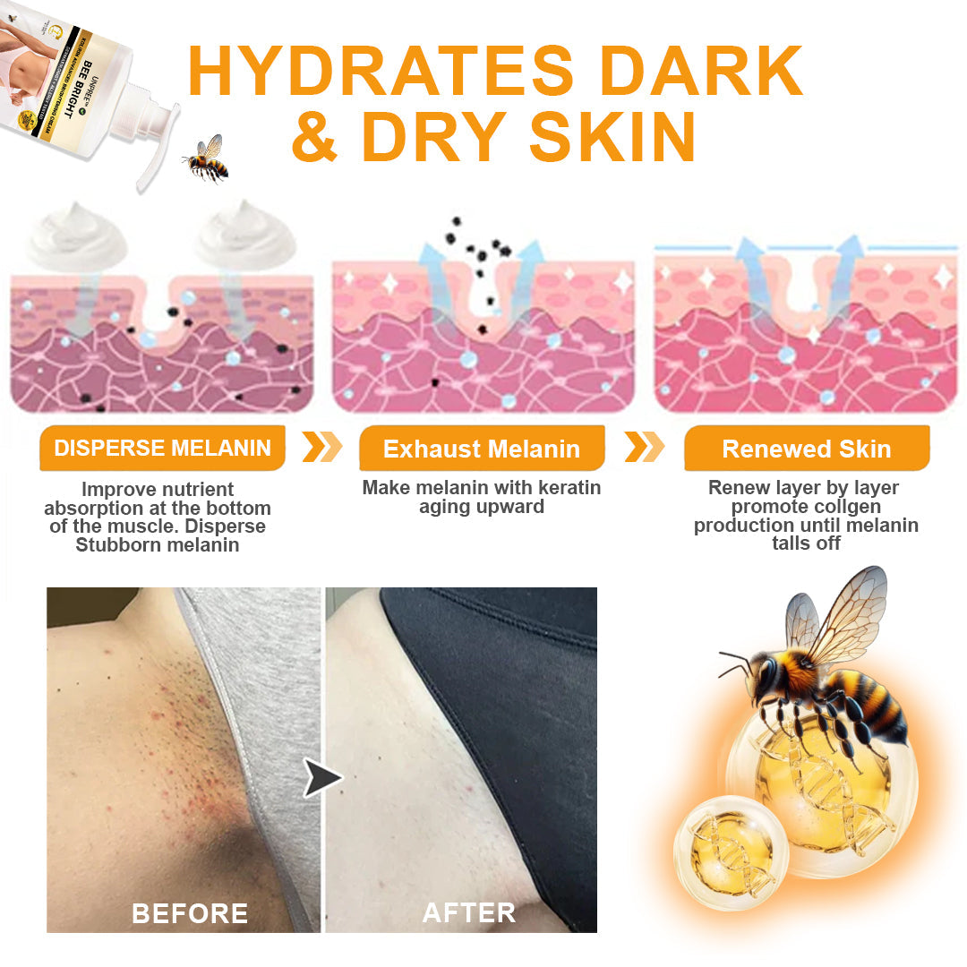 ⏳ Summer Deal 49% OFF ✨ Kolirin™ Bee Venom Dark Spot Corrector