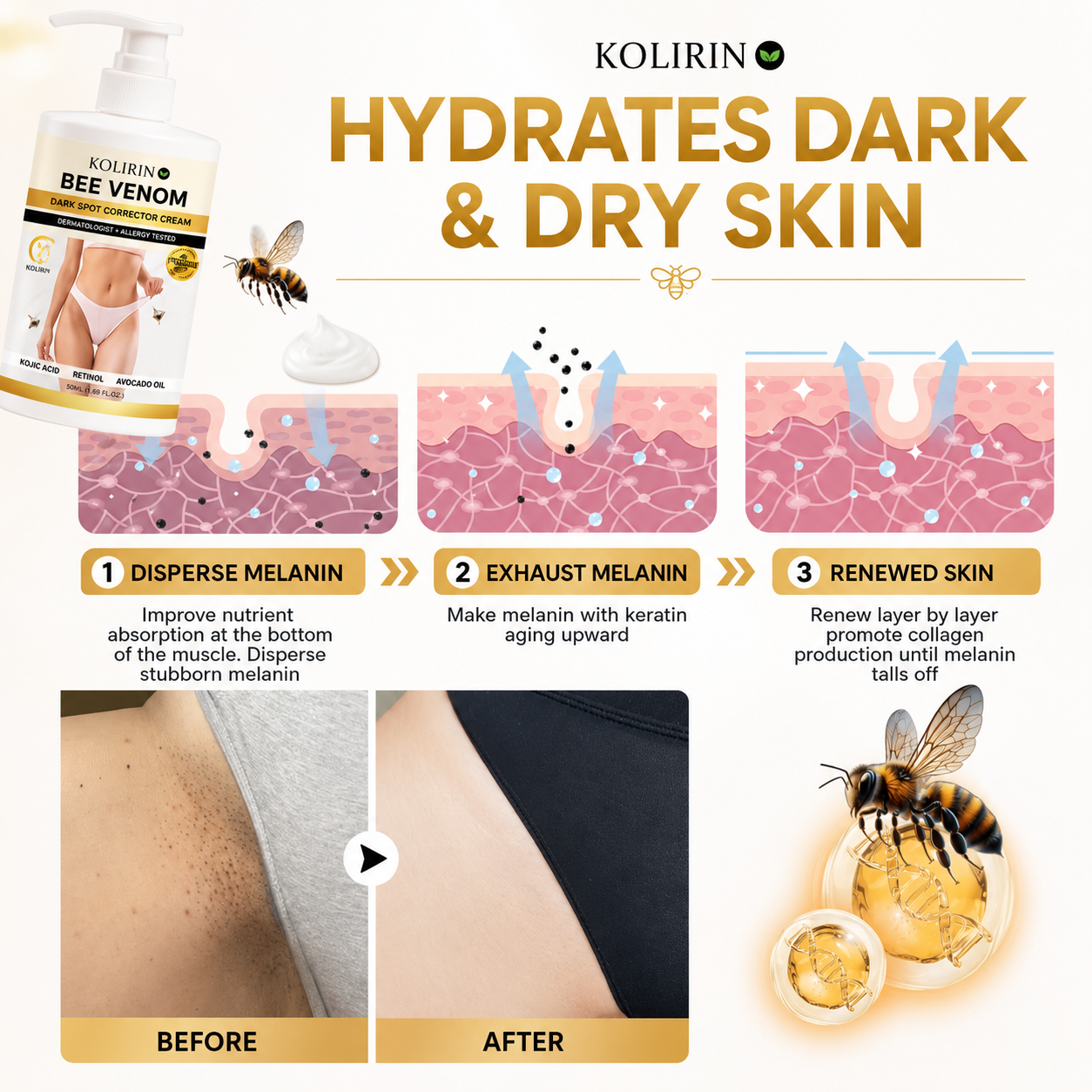 ⏳ Summer Day 50% OFF ✨ Kolirin™ Bee Venom Advanced Dark Spot Corrector