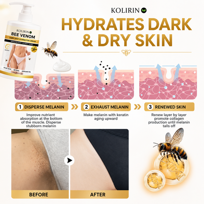 ⏳ Summer Day 50% OFF ✨ Kolirin™ Bee Venom Advanced Dark Spot Corrector