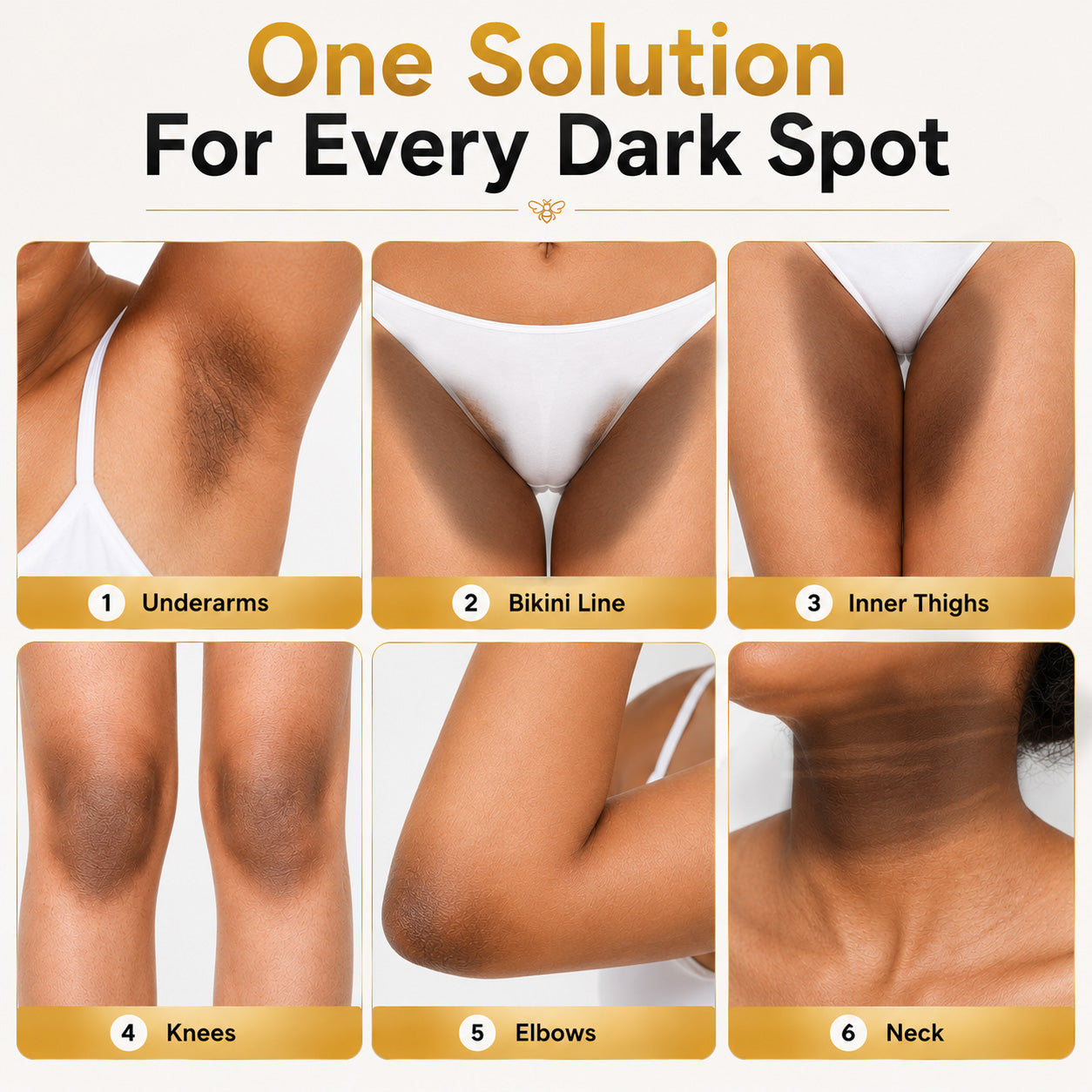 ⏳ Summer Day 50% OFF ✨ Kolirin™ Bee Venom Advanced Dark Spot Corrector